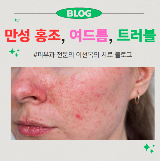 만성 홍조, 트러블, 여드름 고민을 들어드립니다.