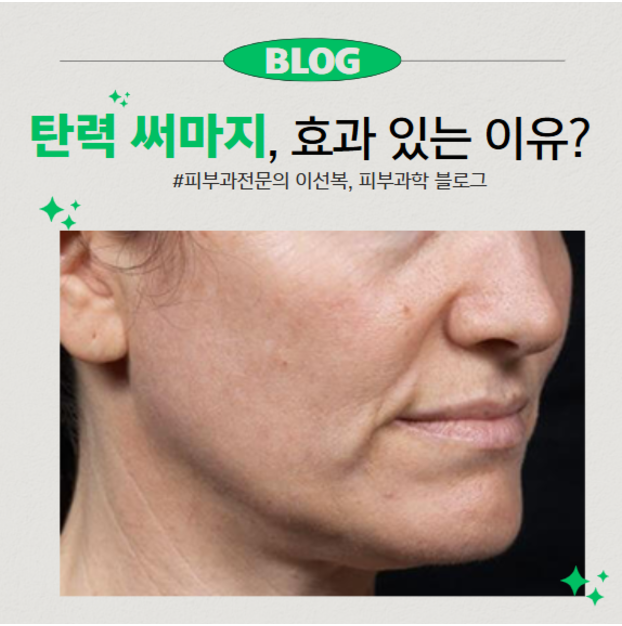 써마지 언박싱/첫개시, 써마지가 필요한 이유